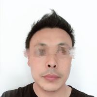 發(fā)際線用戶圖片