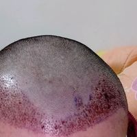 發(fā)際線用戶圖片