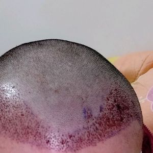 发际线分享社区