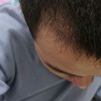 發(fā)際線用戶圖片