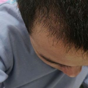 发际线分享社区