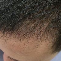 發(fā)際線用戶圖片