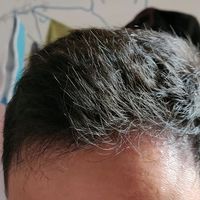 發(fā)際線用戶圖片