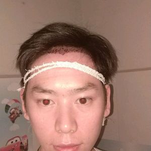 发际线分享社区