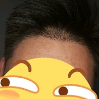 發(fā)際線用戶圖片