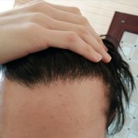 發(fā)際線用戶圖片