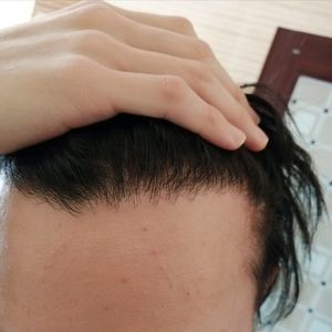 发际线分享社区