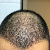發(fā)際線用戶圖片