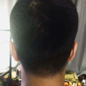 发际线分享社区