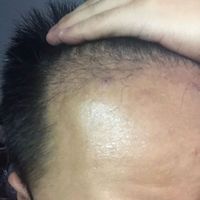 發(fā)際線用戶圖片