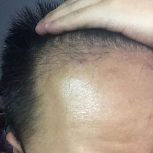 发际线分享社区