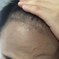 發(fā)際線用戶圖片