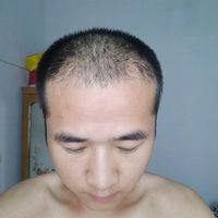 發(fā)際線用戶圖片