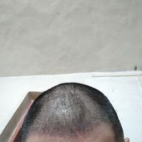 發(fā)際線用戶圖片