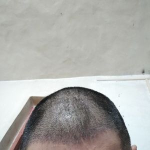 发际线分享社区
