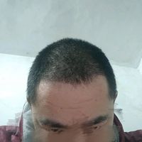 發(fā)際線用戶圖片