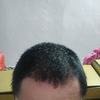 發(fā)際線用戶圖片