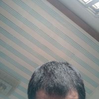 發(fā)際線用戶圖片