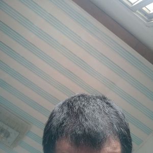 发际线分享社区