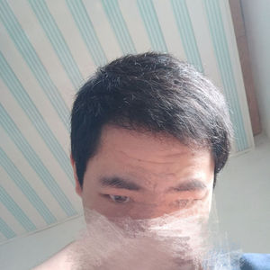 发际线分享社区