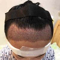 發(fā)際線用戶圖片