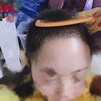發(fā)際線用戶圖片