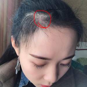 发际线分享社区
