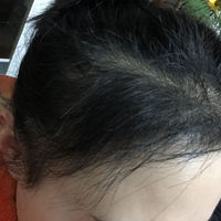 發(fā)際線用戶圖片