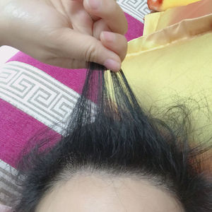 发际线分享社区