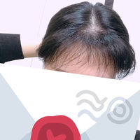 發(fā)際線用戶圖片
