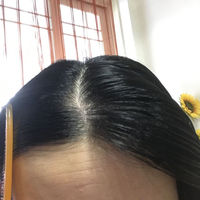 發(fā)際線用戶圖片