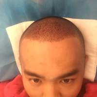 發(fā)際線用戶圖片