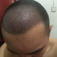 發(fā)際線用戶圖片