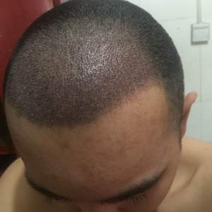 发际线分享社区