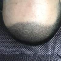 發(fā)際線用戶圖片
