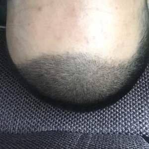 发际线分享社区