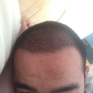 发际线分享社区