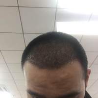 發(fā)際線用戶圖片