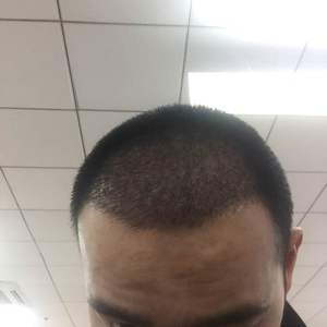 发际线分享社区