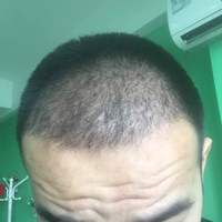 發(fā)際線用戶(hù)圖片