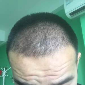 发际线分享社区