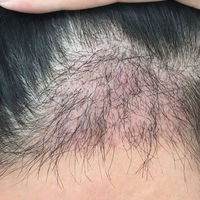 發(fā)際線用戶(hù)圖片