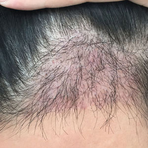 发际线分享社区