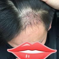 發(fā)際線用戶(hù)圖片