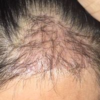 發(fā)際線用戶(hù)圖片
