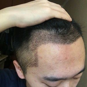 发际线分享社区
