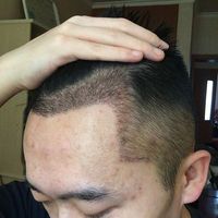 發(fā)際線用戶(hù)圖片