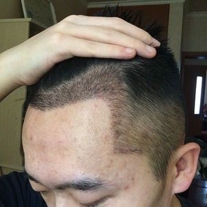 发际线分享社区