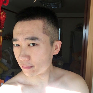 发际线分享社区
