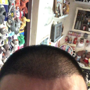 发际线分享社区